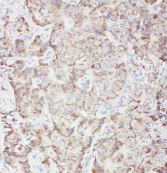 IRF1 Rabbit Polyclonal Antibody