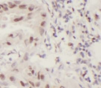 IRF2BP2 Antibody
