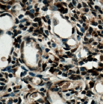IRF4 Antibody