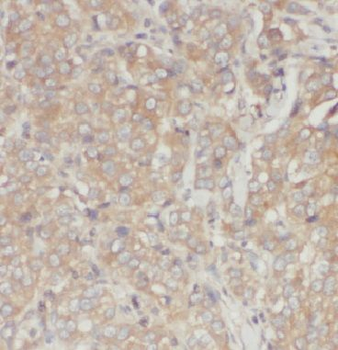 IRF5 Antibody