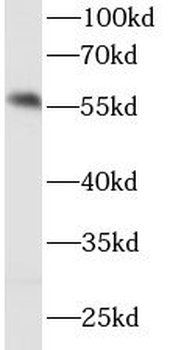 IRF5 Mouse Monoclonal Antibody