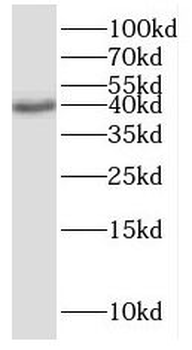ISG20L2 Rabbit Polyclonal Antibody