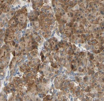 ISYNA1 Antibody