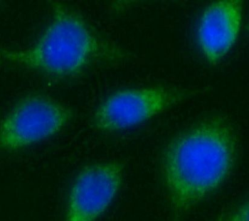 ITGB1BP2 Antibody