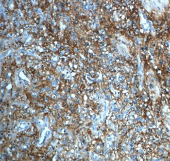 ITIH3 Antibody