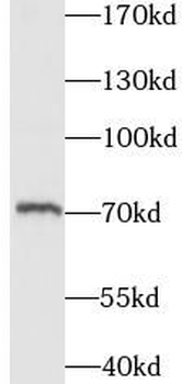 ITK Rabbit Polyclonal Antibody
