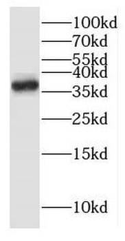 ITLN1 Antibody