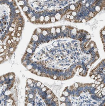 ITLN1 Antibody