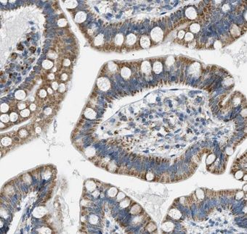 ITM2C Antibody