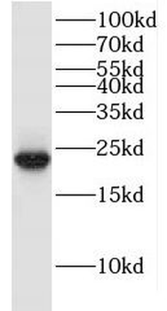 ITPA Antibody