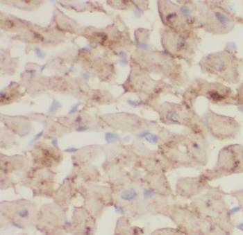 ITPA Antibody