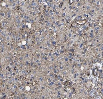 ITPKA Antibody