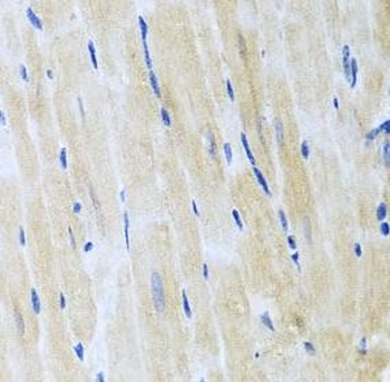 ITPKB Antibody