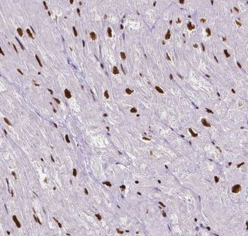ITPKC Antibody