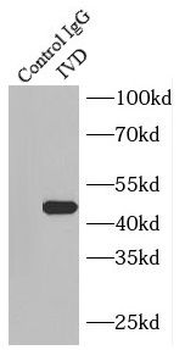 IVD Antibody
