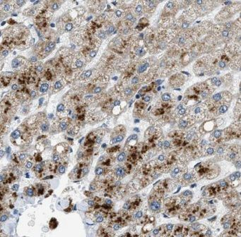 IVD Antibody