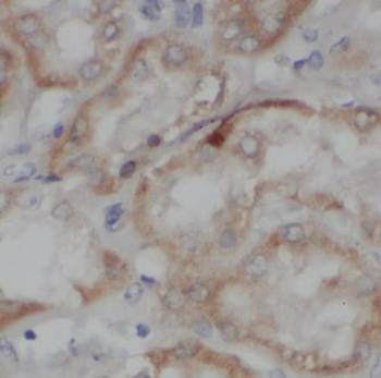 IVNS1ABP Antibody