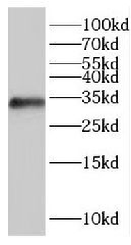 IYD Antibody
