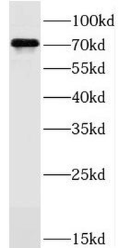 JAKMIP1 Rabbit Polyclonal Antibody