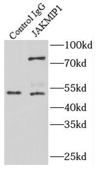 JAKMIP1 Rabbit Polyclonal Antibody
