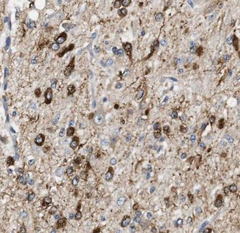 JAKMIP1 Rabbit Polyclonal Antibody