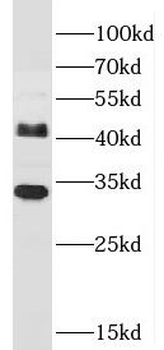 JAM2 Antibody