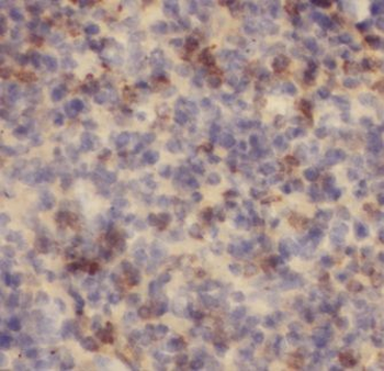 JAML Antibody