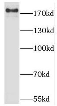 KDM6B Antibody