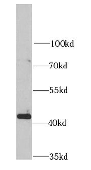 JMJD6 Antibody