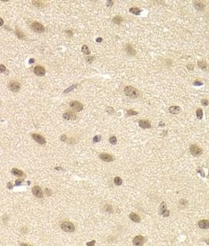 JMJD6 Antibody
