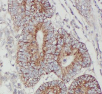 JMY Antibody