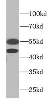 MAPK8 Rabbit Polyclonal Antibody