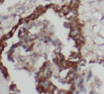 MAPK8 Rabbit Polyclonal Antibody
