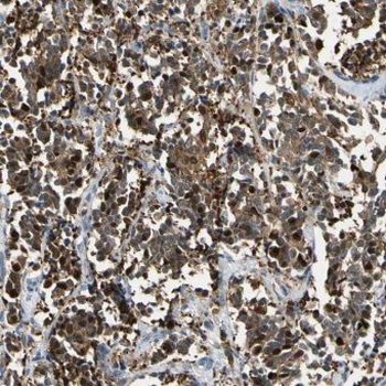 MAPK8 Rabbit Polyclonal Antibody