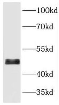 MAPK9 Rabbit Polyclonal Antibody
