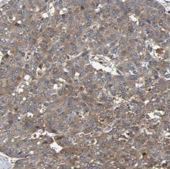 JPH2 Rabbit Polyclonal Antibody