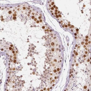 AIMP2 Antibody