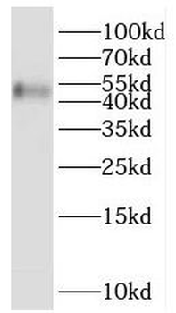 SERPINA4 Rabbit Polyclonal Antibody