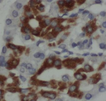 SERPINA4 Rabbit Polyclonal Antibody