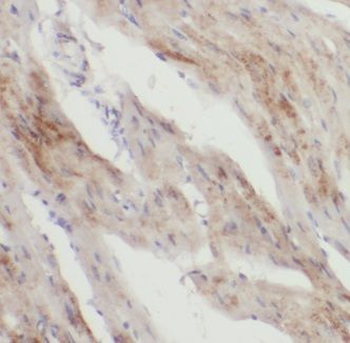 KANK1 Antibody