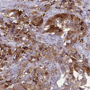KARS1 Antibody