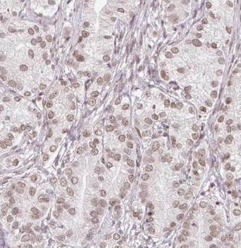 KAT5 Rabbit Polyclonal Antibody