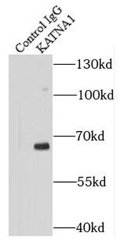 KATNA1 Antibody