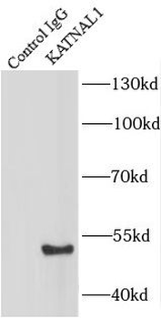 KATNAL1 Antibody