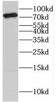 KATNB1 Antibody