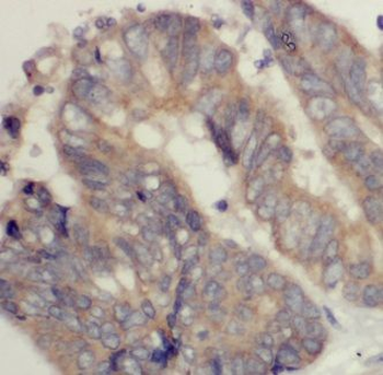 KAZN Antibody