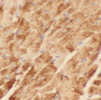 KLHL41 Antibody