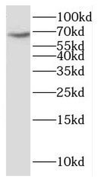 KBTBD2 Rabbit Polyclonal Antibody