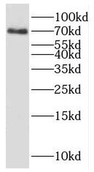KLHL40 Rabbit Polyclonal Antibody
