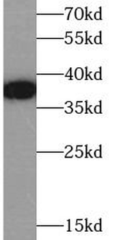 KCNAB2 Antibody